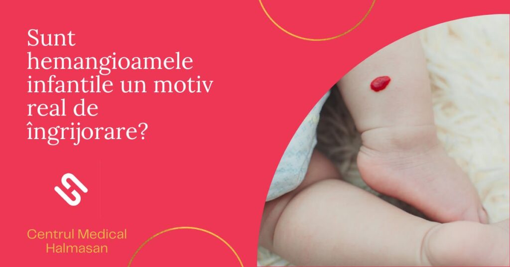 hemangioamele-infantile