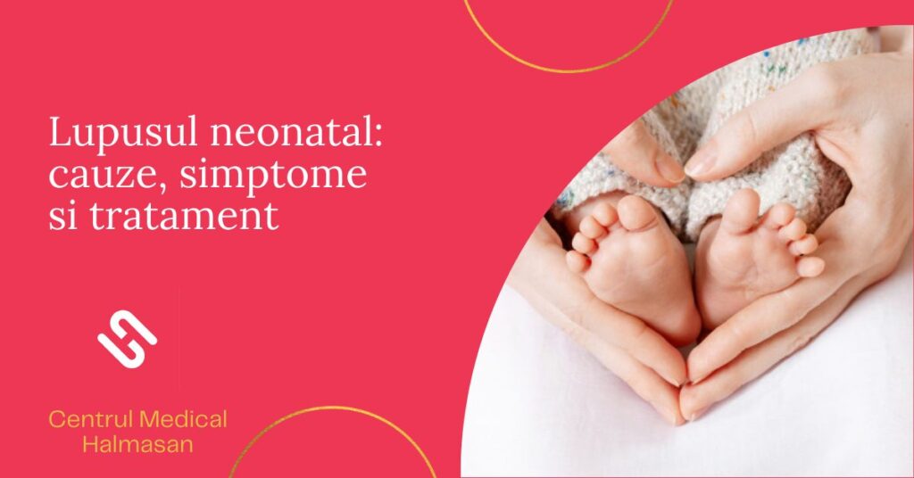 Lupusul neonatal - cauze, simptome si tratament